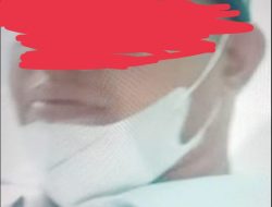 Wau…!!! Dugaan Kadus Berinisial W Pemotongan Dana BLT Desa Galang Suka, Menganiaya Oknum Wartawan Media Online Metroinvestigasinews.com