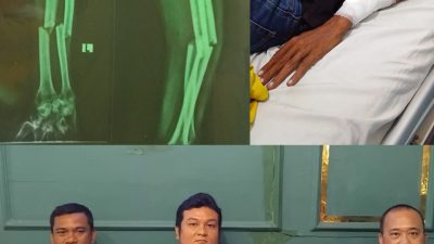 Tangan Patah dipukul Residivis, Idran Ismi Bantah Korban Jadikan Tersangka