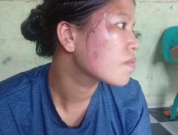 Dewi Korban Penganiayaan Brutal yang dilakukan oleh Kawan Kerjanya